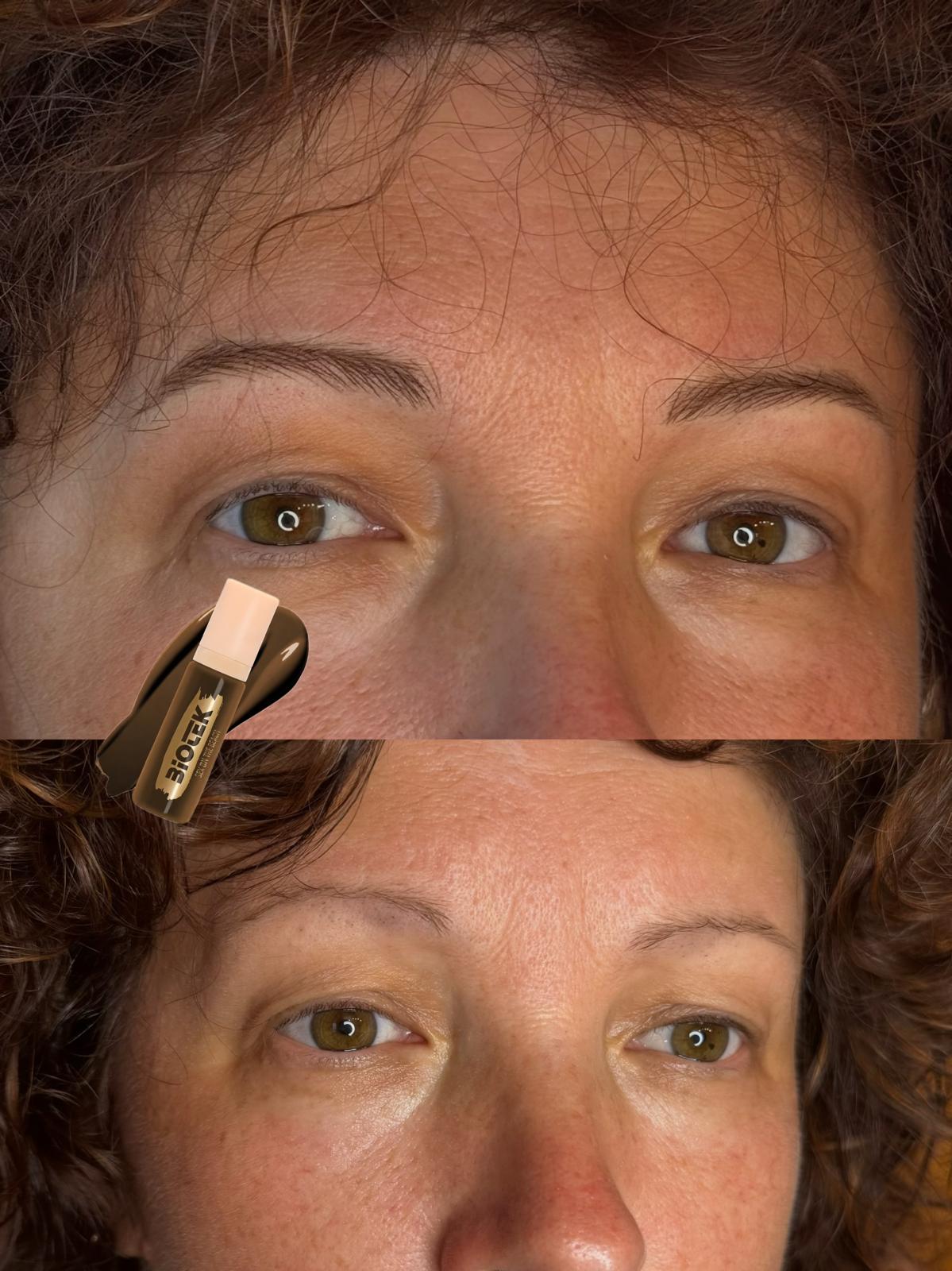 Prima e dopo trucco permanente Roma 03