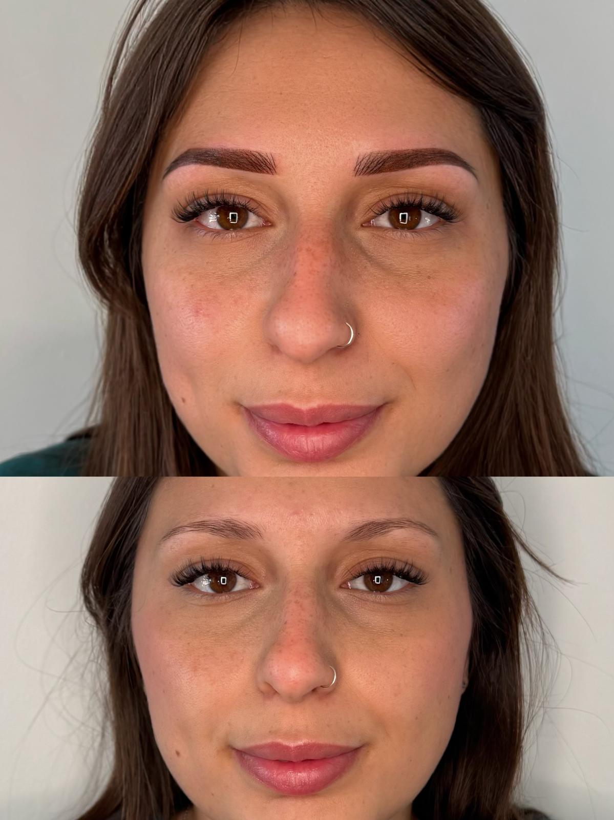 Prima e dopo trucco permanente Roma 05